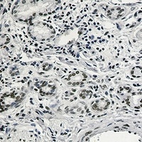 RAD21 antibody