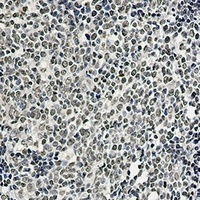 Anti-hnRNP I Antibody