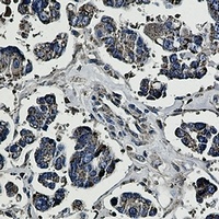 Anti-Prohibitin Antibody