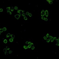 Anti-Prohibitin Antibody