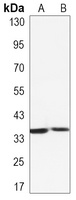 L1RE1 Rabbit Monoclonal Antibody