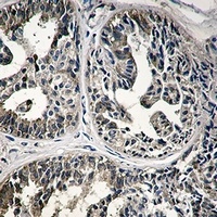 Anti-IMPDH2 Antibody