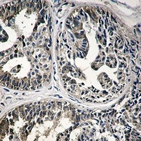 IMPDH2 antibody