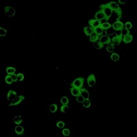 Anti-IMPDH2 Antibody
