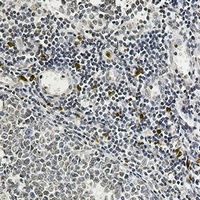 Anti-IL-26 Antibody