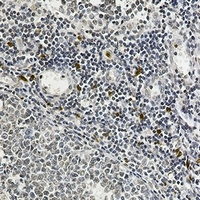 IL-26 antibody