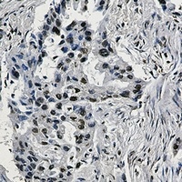 Anti-HIF1 beta Antibody