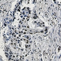 HIF1 beta antibody