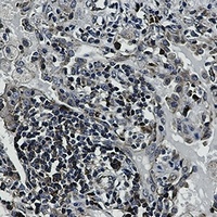 Anti-EIF4B Antibody