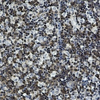 DGK alpha antibody