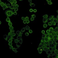 Collagen 1 alpha 1 Antibody