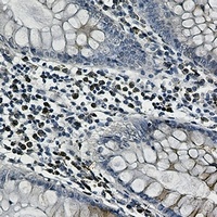 Anti-CLSTN1 Antibody