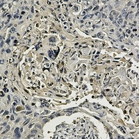 Anti-CCT2 Antibody