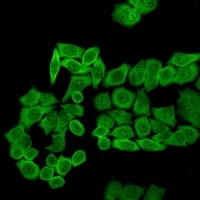 Anti-CCT2 Antibody