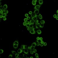 Anti-BID Antibody
