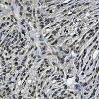 Anti-BCR Antibody