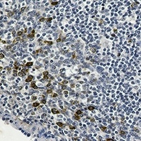 Anti-p53 (Phospho-S6) Antibody