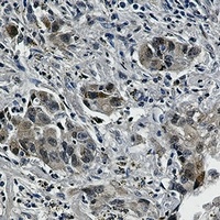EGFR (phospho-Y1173) antibody