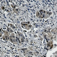 Anti-EGFR (Phospho-Y1173) Antibody
