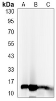 Histone H3 (Acetyl-K27) Antibody