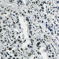 Anti-Histone H3 (Acetyl-K27) Antibody