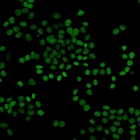 Anti-Histone H3 (Acetyl-K27) Antibody