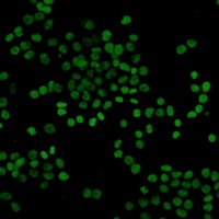 Histone H3 (AcK27) antibody