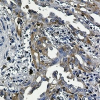 Anti-RSK3 Antibody