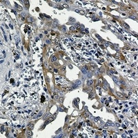 RSK3 antibody