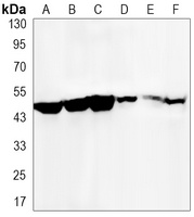 KIM1 Antibody