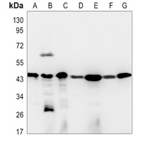 CD142 Antibody