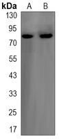 FOXO3 Rabbit Monoclonal Antibody