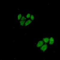 Anti-Wnt-5a Antibody
