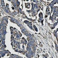 Anti-WDR1 Antibody