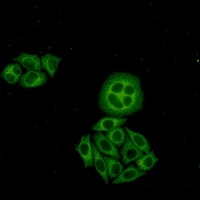 Anti-WDR1 Antibody
