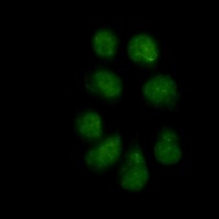 Vimentin (phospho-S56) antibody