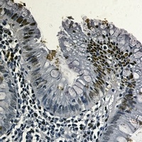 Anti-Topoisomerase 1 Antibody
