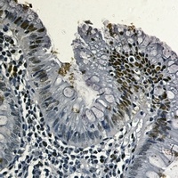 Topoisomerase 1 antibody