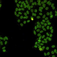 Anti-Topoisomerase 1 Antibody