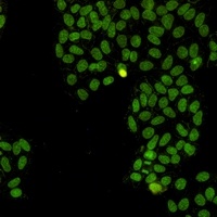 Topoisomerase 1 antibody