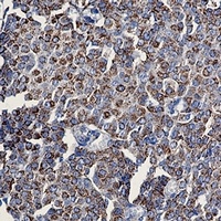 Anti-TOM20 Antibody