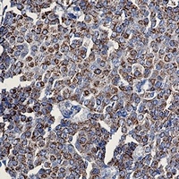 TOM20 antibody