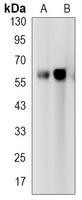 TCF7L2 Antibody