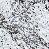 Anti-TCF7L2 Antibody