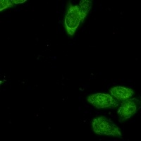 Survivin Antibody