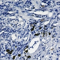 SMAD2 Antibody