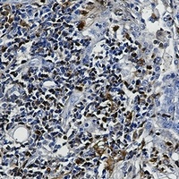 S100-A4 antibody