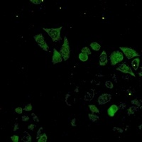 Anti-S100-A4 Antibody