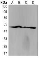PTEN Rabbit Monoclonal Antibody