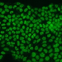 Anti-PCNA Antibody